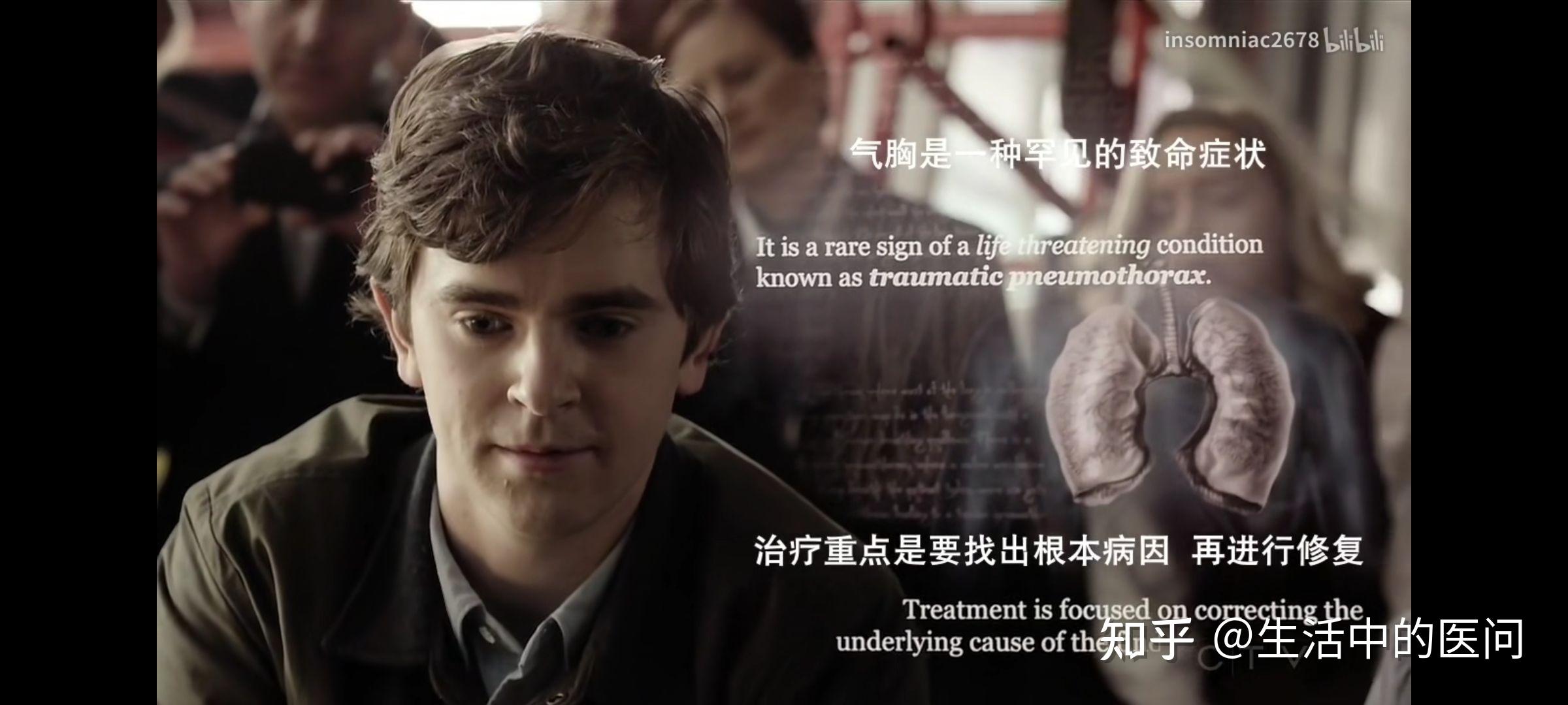 美剧良医第一季(美剧良医第一季在线播放)